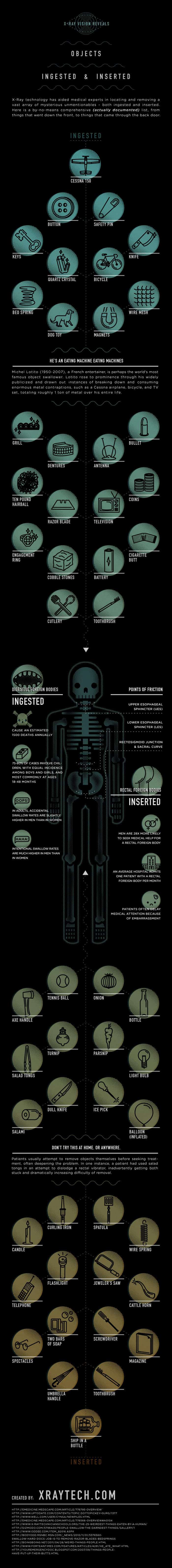 Most Obscure Objects Ingested or Inserted Infographic