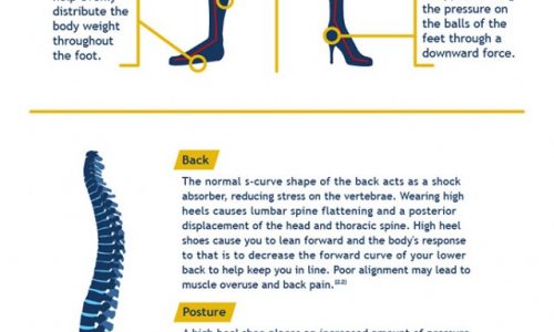 How high heels hurt your body infographic