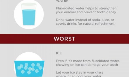 the best and worst Foods and beverages for your teeth infographic