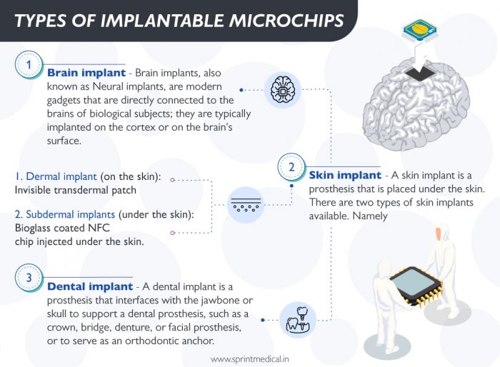 Kinds Of Implanted Microchips